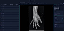 Xray