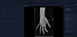Xray