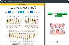 Treatment Test Print/O