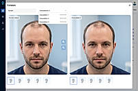 Consultation Compare