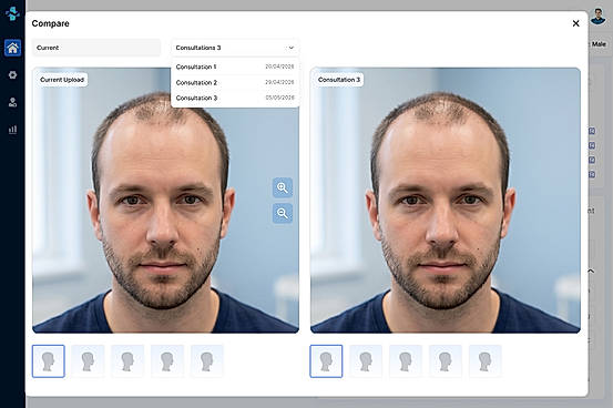 Consultation Compare